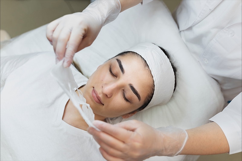 Chemical Peels